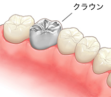 クラウン